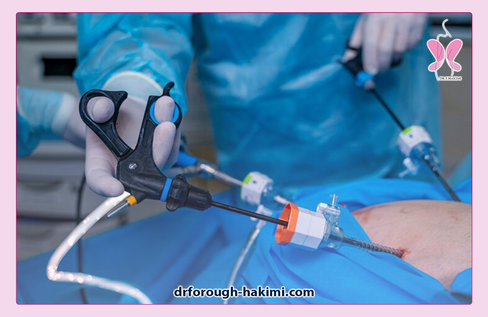 عمل لاپاراسکوپی کیسه صفرا چگونه است؟