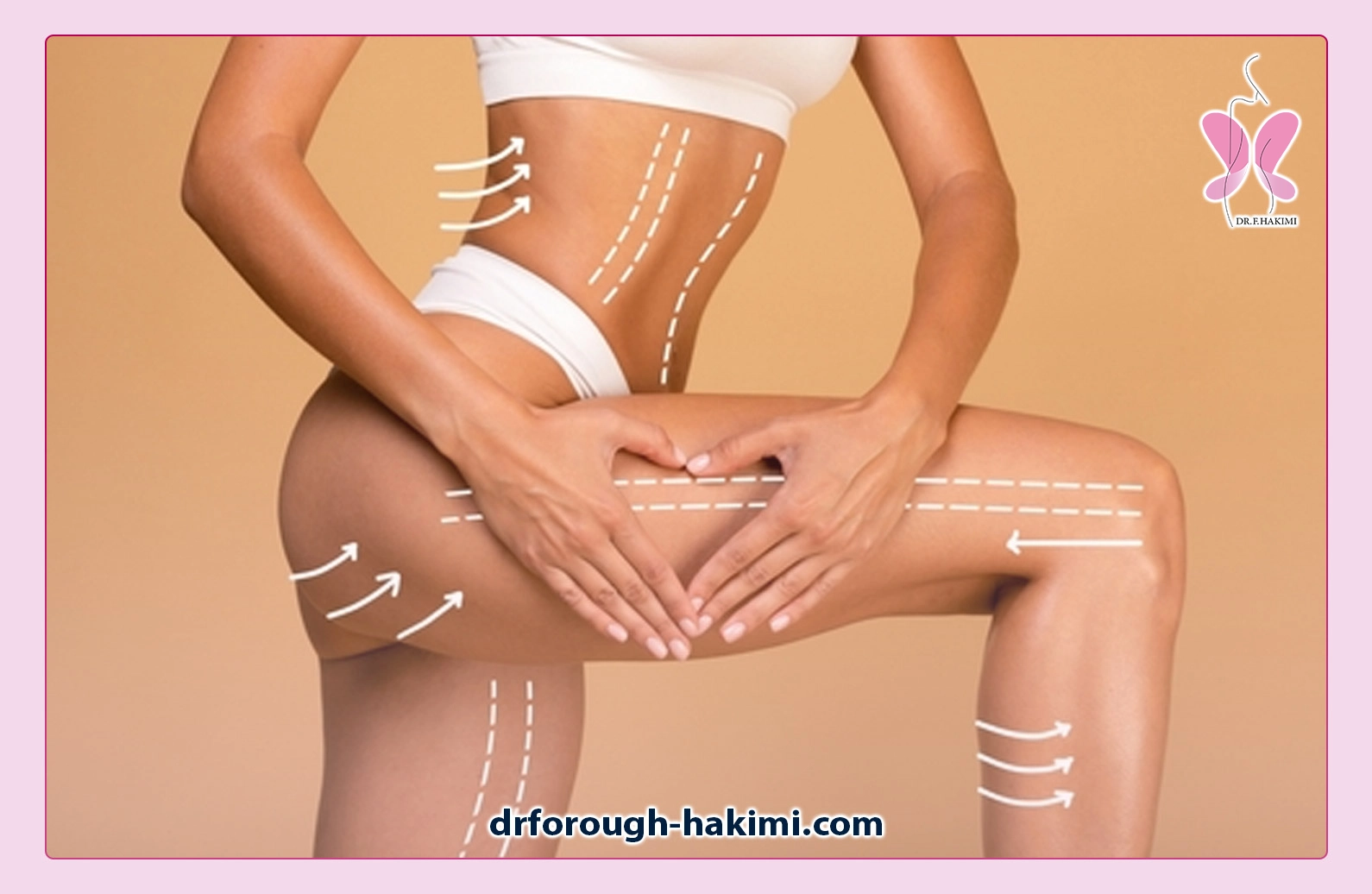 پیکرتراشی در شهریار