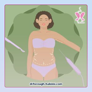 تزریق چربی در اندیشه