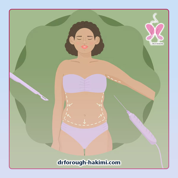 تزریق چربی در اندیشه