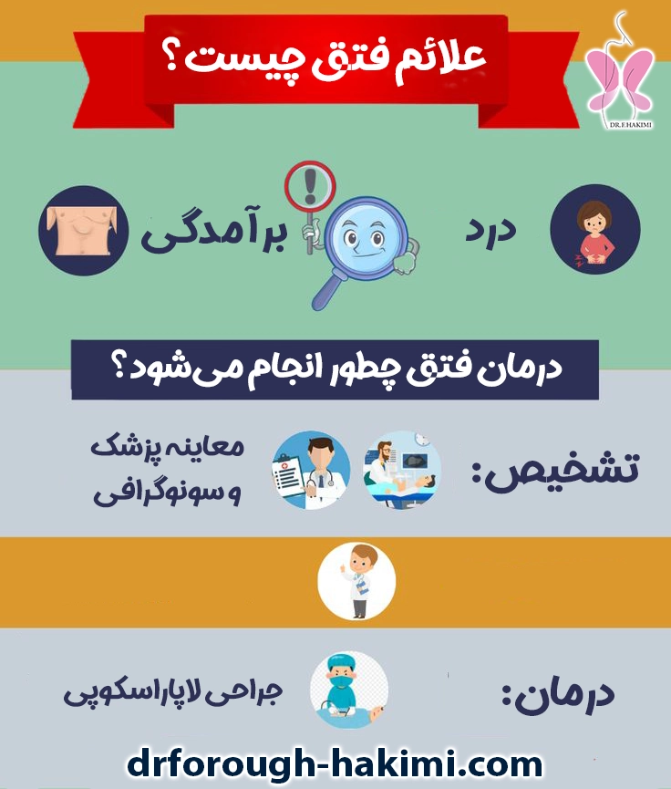 علائم و درمان فتق