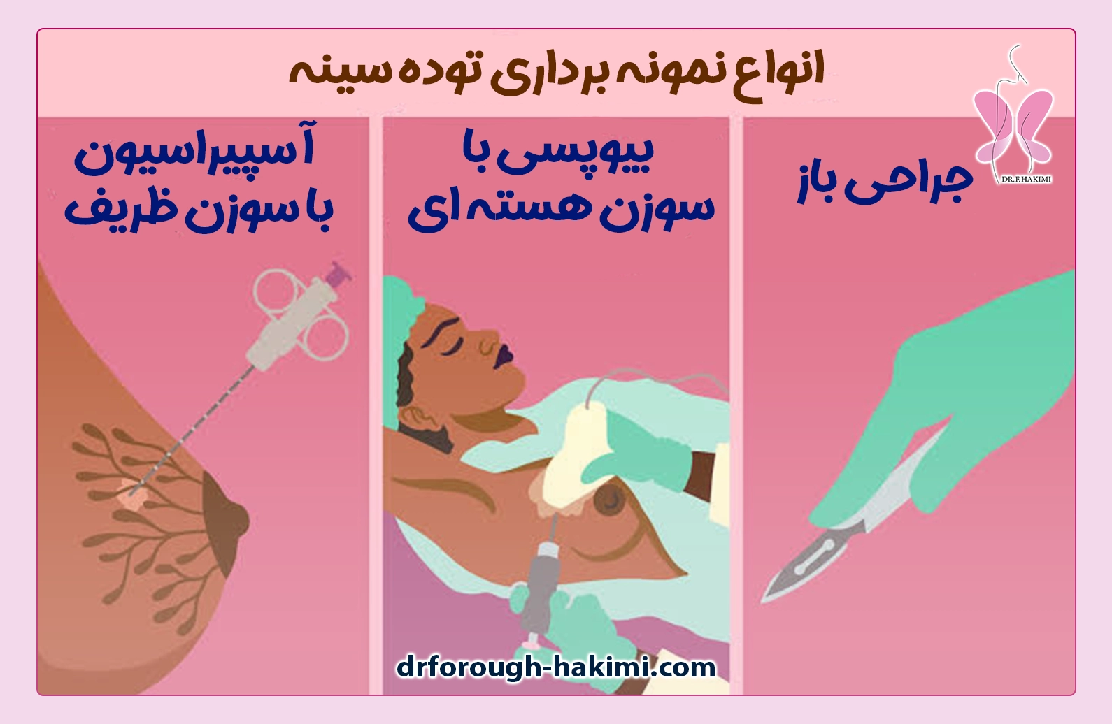 انواع نمونه برداری توده سینه در شهریار