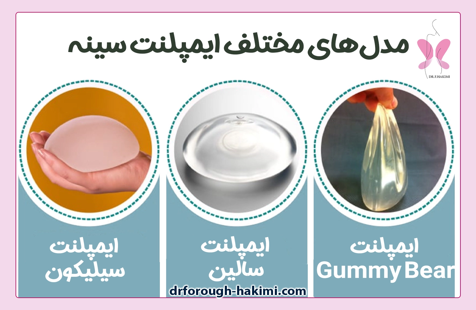 مدل های پروتز سینه