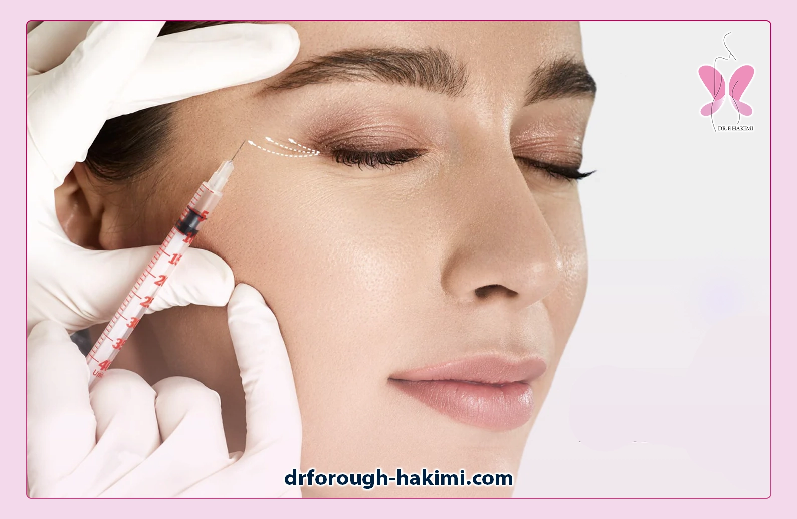 چه موادی در مزوتراپی زیر چشم استفاده می‌شوند؟