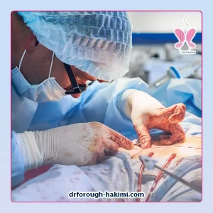 بخیه ابدومینوپلاستی